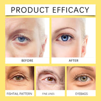 Snail Essence Eye Patches Dark Circles and Wrinkles Hydrating Under Eye Mask Deep Moisture Anti Aging Rejuvenating Gel Pads60pcs