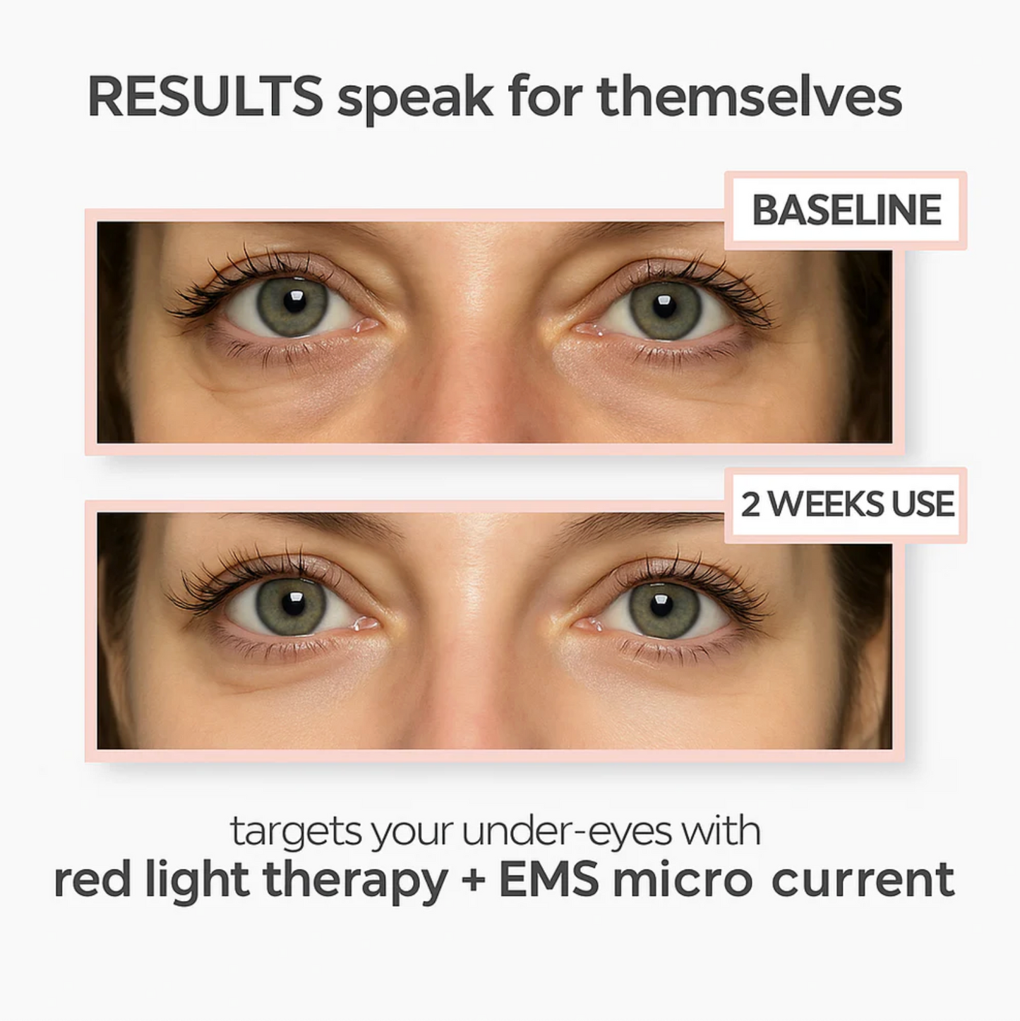 LumiLift™: Red Light Eye Therapy for Puffiness & Fine Lines