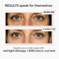 LumiLift™: Red Light Eye Therapy for Puffiness & Fine Lines