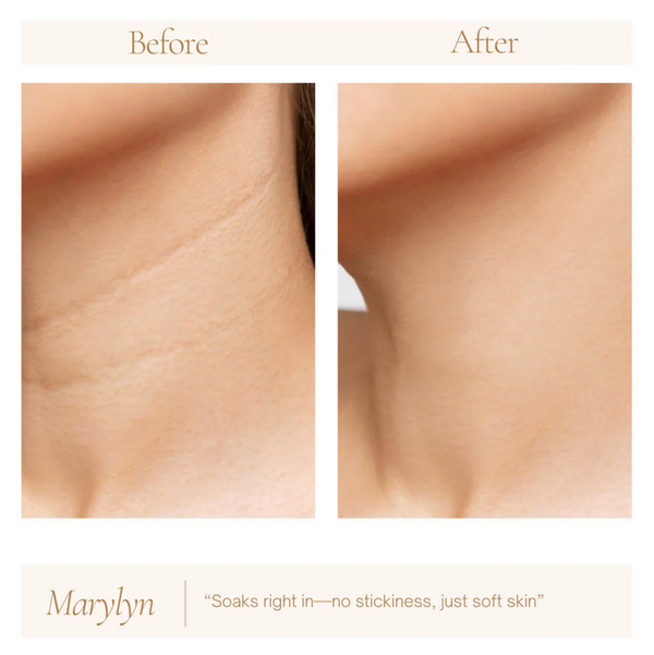 Hyaluronic Acid 2% + b5 Hydrating Serum