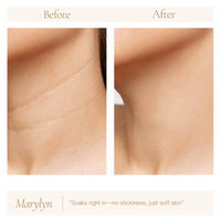 Hyaluronic Acid 2% + b5 Hydrating Serum