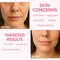 LumiSculpt™: EMS Gua Sha for Lift, Contour & Drainage