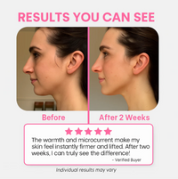 LumiSculpt™: EMS Gua Sha for Lift, Contour & Drainage